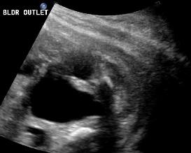 2.PUV.bld.outletobst.