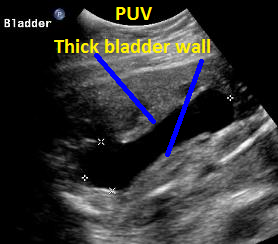 5.PUV.thick.bld.wall