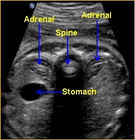 Images of Normal Fetal Adrenal Gland by OB Images
